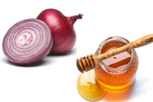 9 Amazing Health Benefits of Onion and Honey