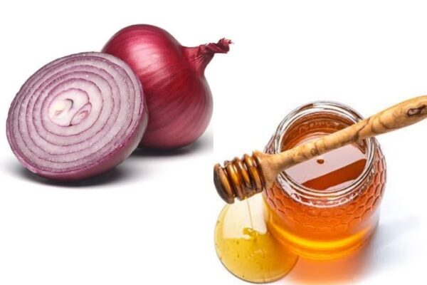 9 Amazing Health Benefits of Onion and Honey